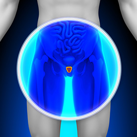 Enlarged Prostate Treatment in Tarzana, CA